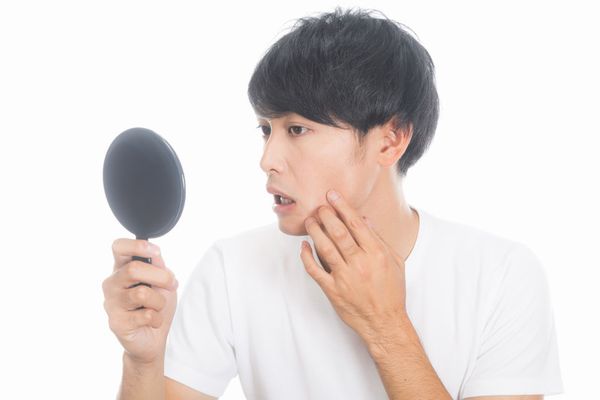 ニキビの手入れ